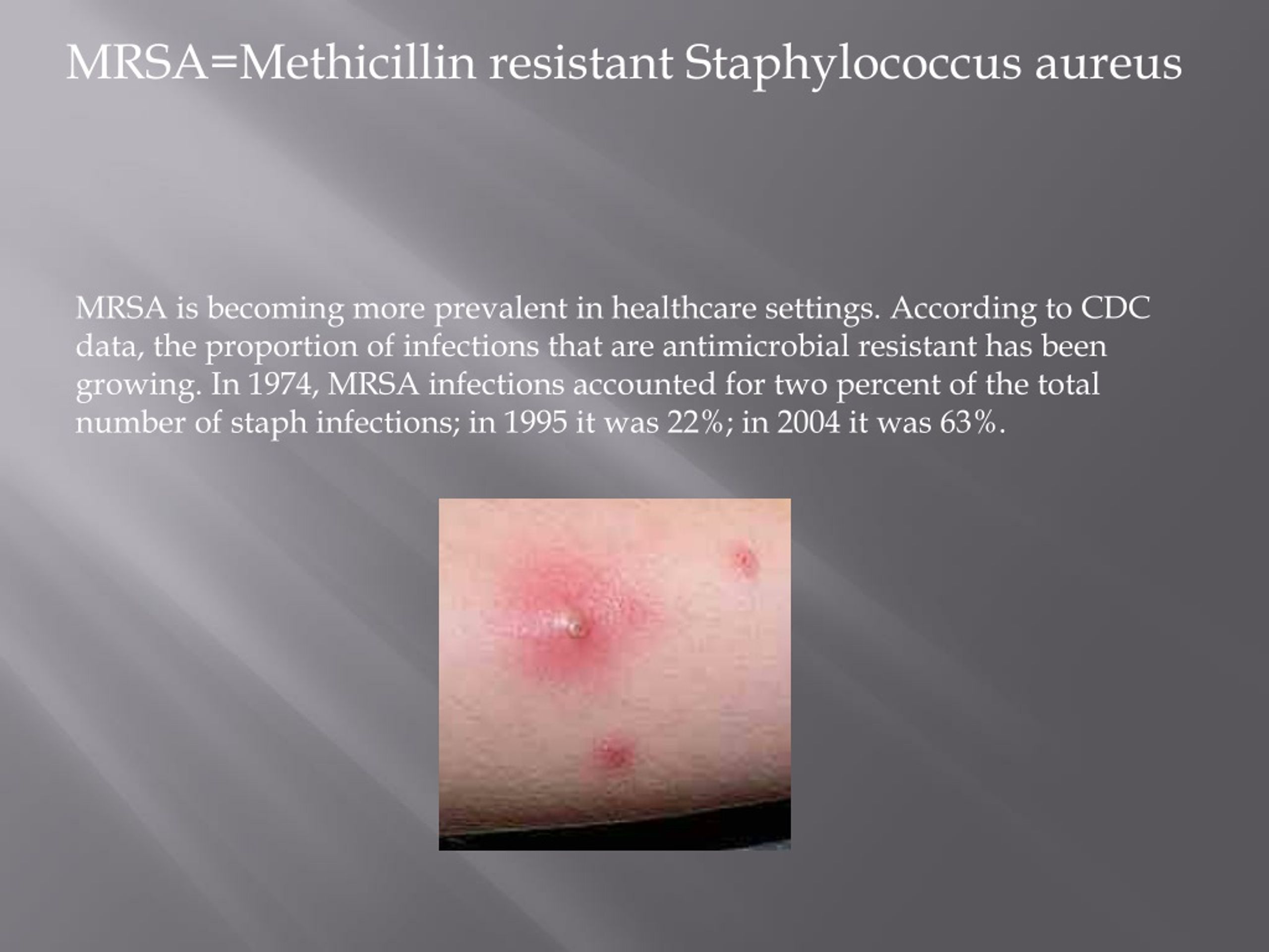 What Is MRSA?, Staph Infections