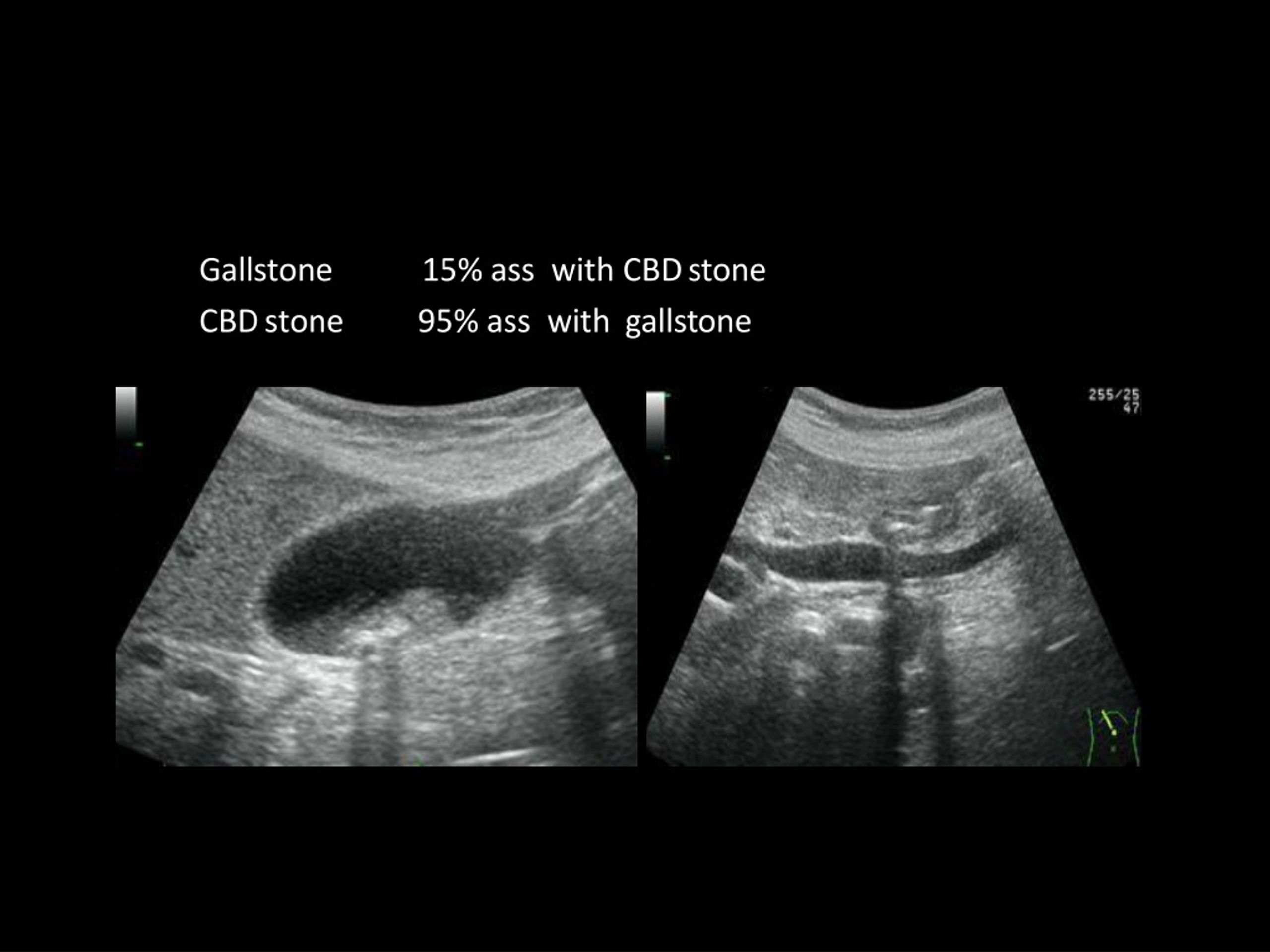 PPT Ni T T A Y A Cham A Do L MD Radiolo G Ist Department Of Radiology 