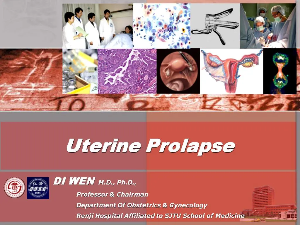Ppt Uterine Prolapse Powerpoint Presentation Free Download Id483273 