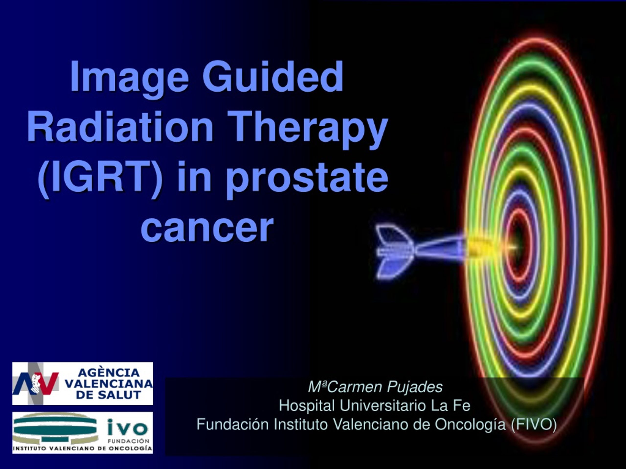 PPT - Image Guided Radiation Therapy (IGRT) In Prostate Cancer ...