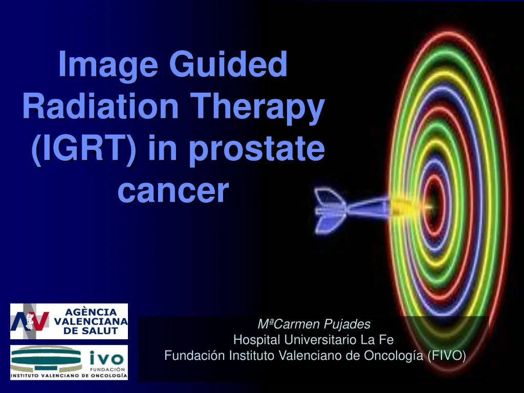 Ppt Image Guided Radiation Therapy Igrt In Prostate Cancer Powerpoint Presentation Id495537 3489