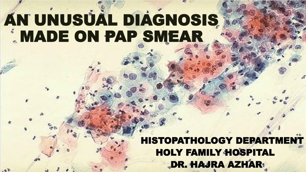 Ppt An Unusual Diagnosis Made On Pap Smear Powerpoint Presentation