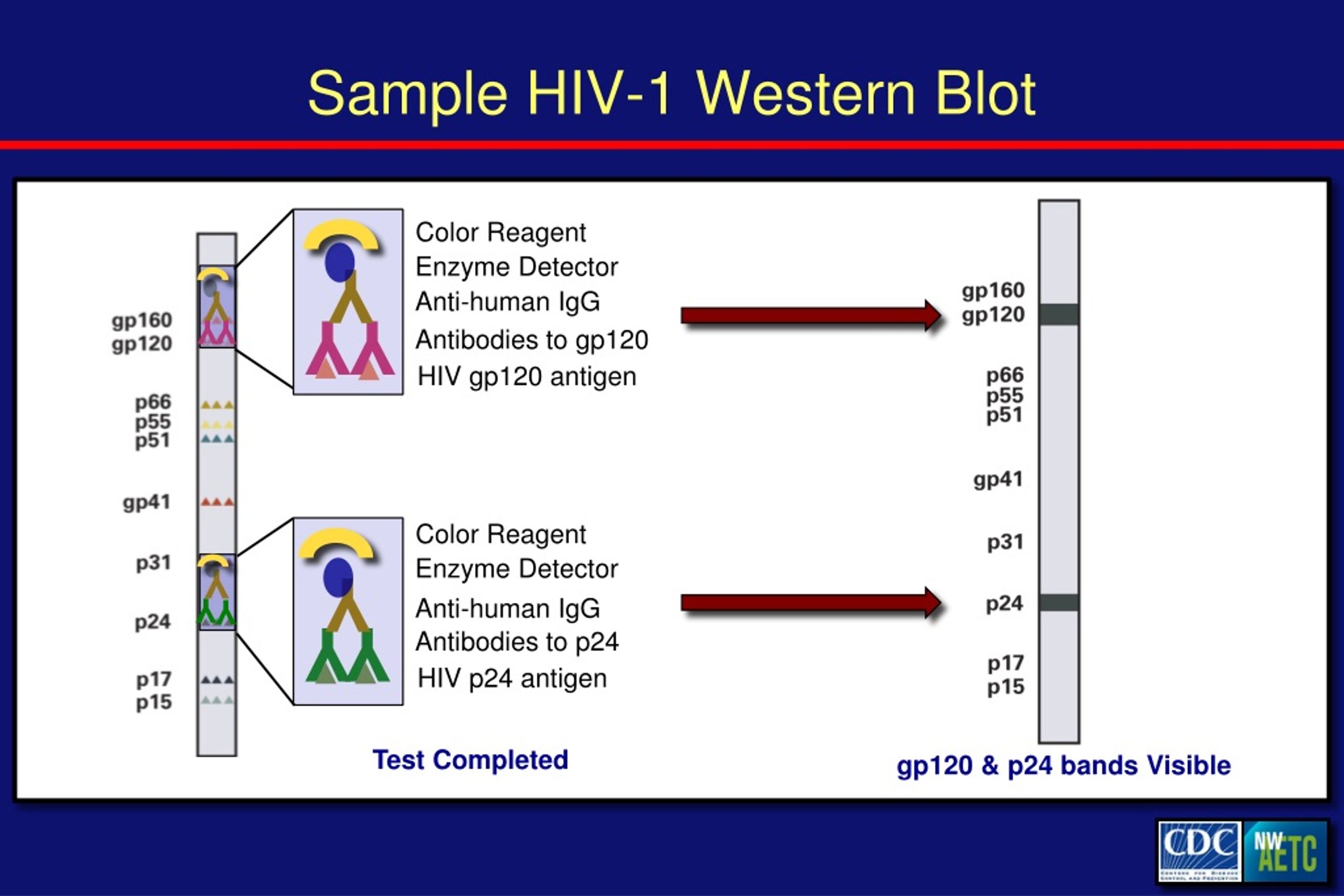 western blot test for hiv ppt