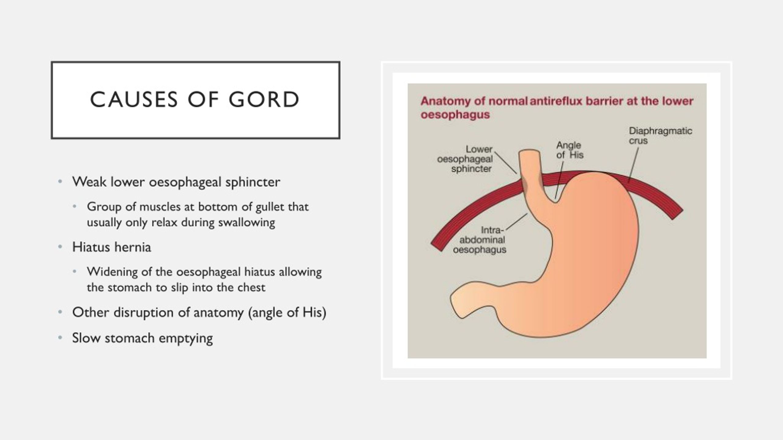 gord causes