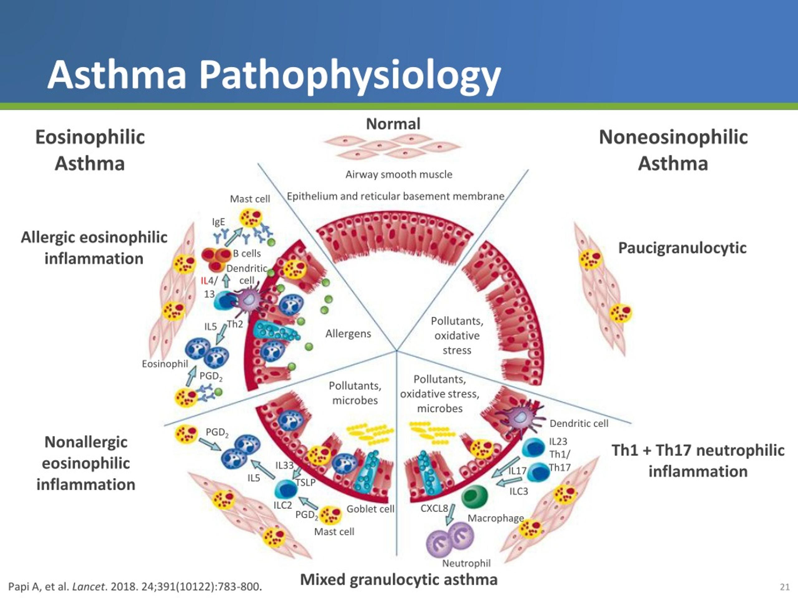 PPT - Improving Control in Severe Asthma PowerPoint Presentation, free ...