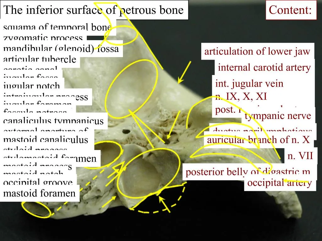 PPT - The inferior surface of petrous bone PowerPoint Presentation