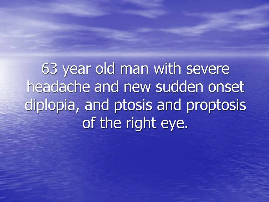 Ppt 63 year old man with severe headache and new sudden onset