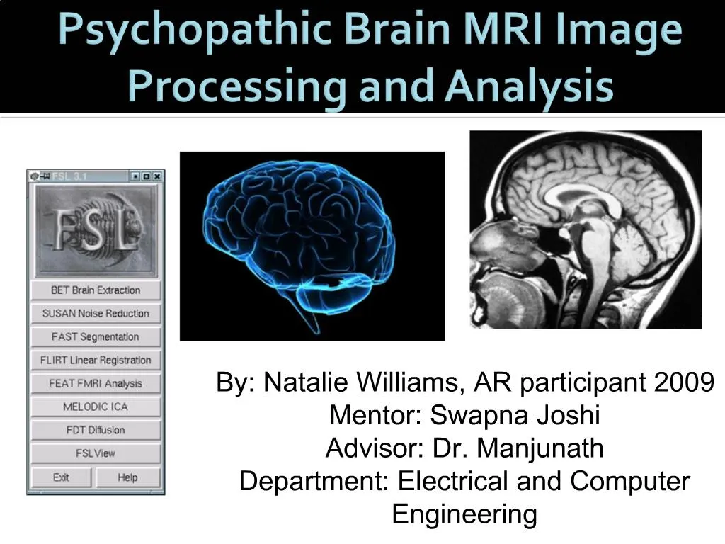 Ppt Psychopathic Brain Mri Image Processing And Analysis Powerpoint ...