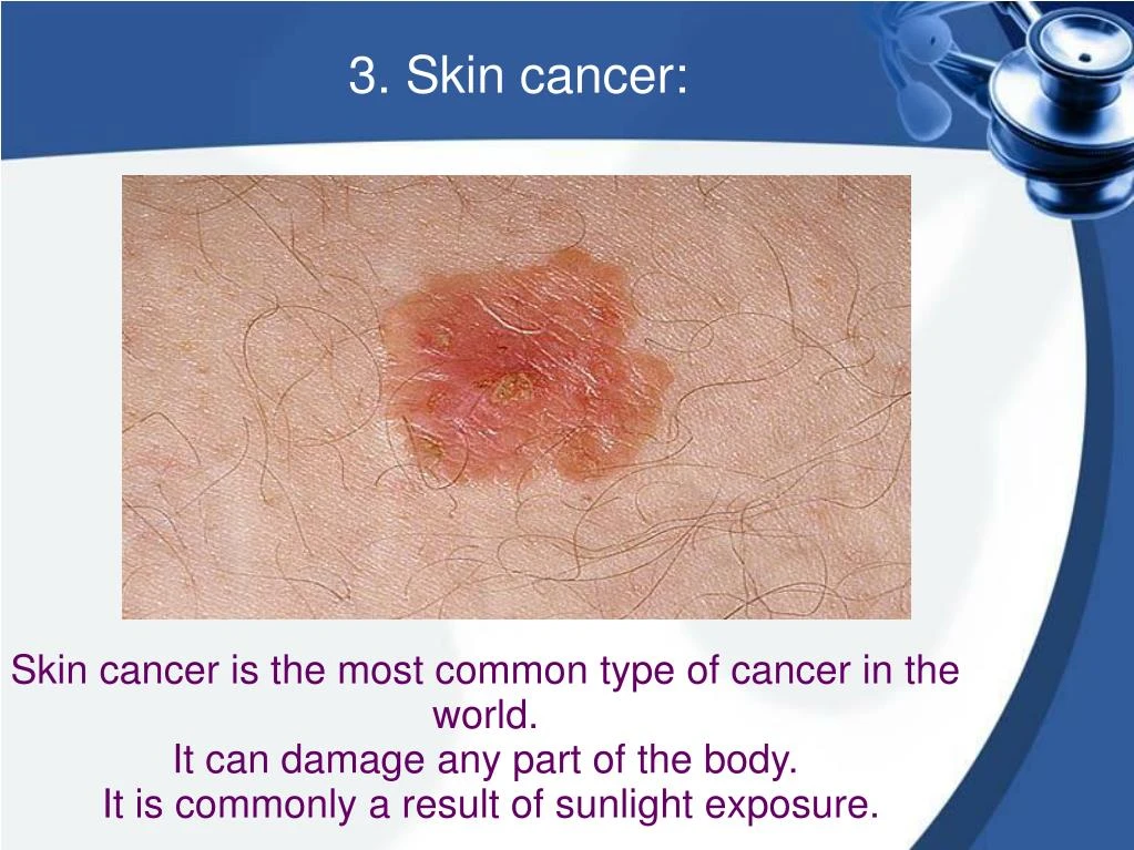 PPT - What Are The Common Skin Problems? PowerPoint Presentation - ID ...