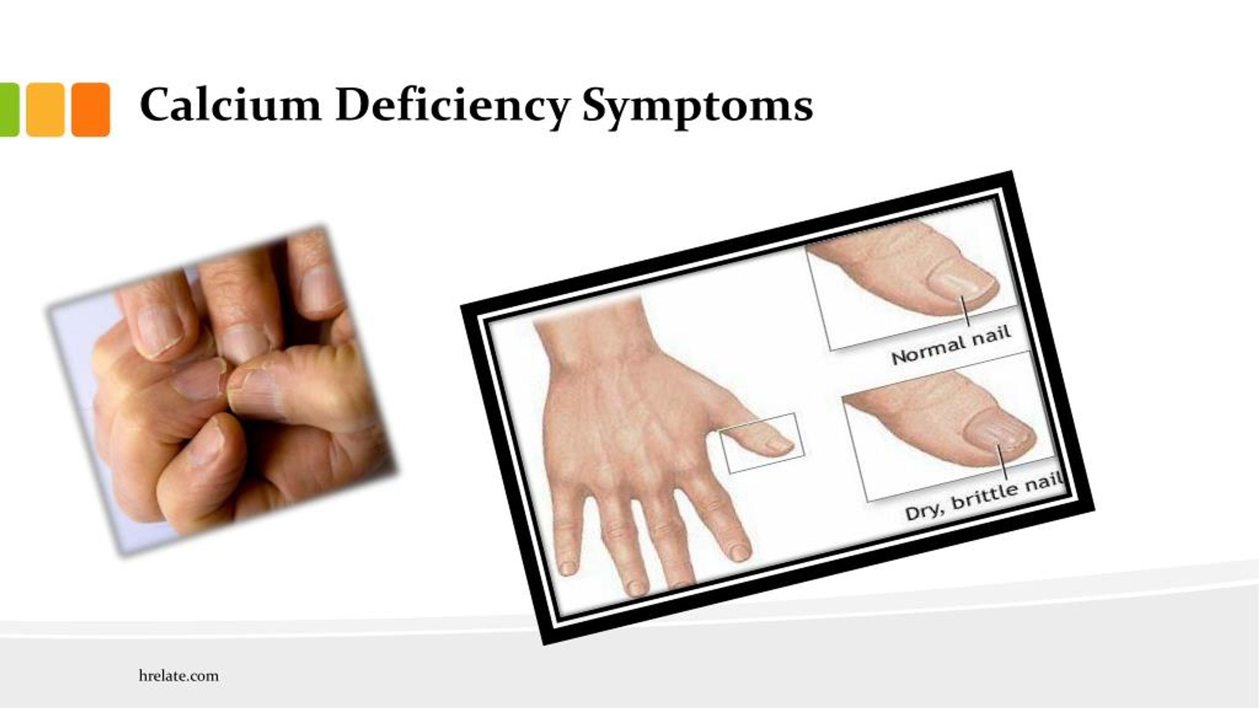 PPT - Calcium Deficiency Symptoms: Iski Kami ko Pehchane PowerPoint ...