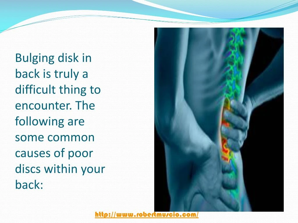 ppt-causes-symptoms-and-treatment-of-a-bulging-disc-lower-back