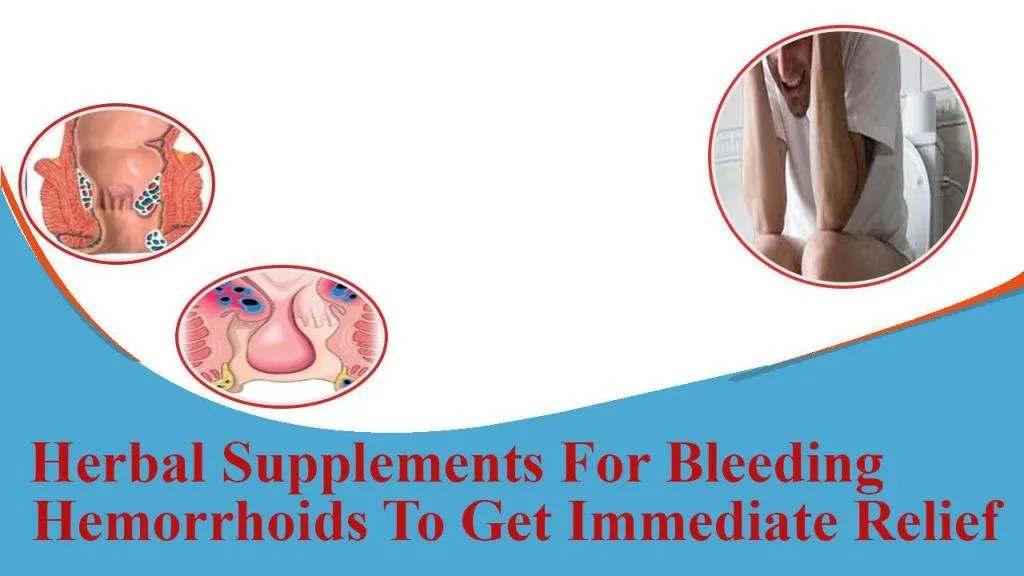 Ppt Herbal Supplements For Bleeding Hemorrhoids To Get Immediate Powerpoint Presentation Id 5309