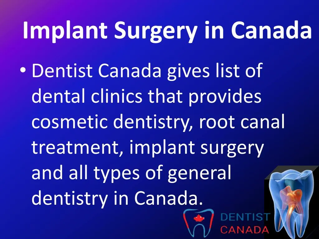implant surgery in canada n.