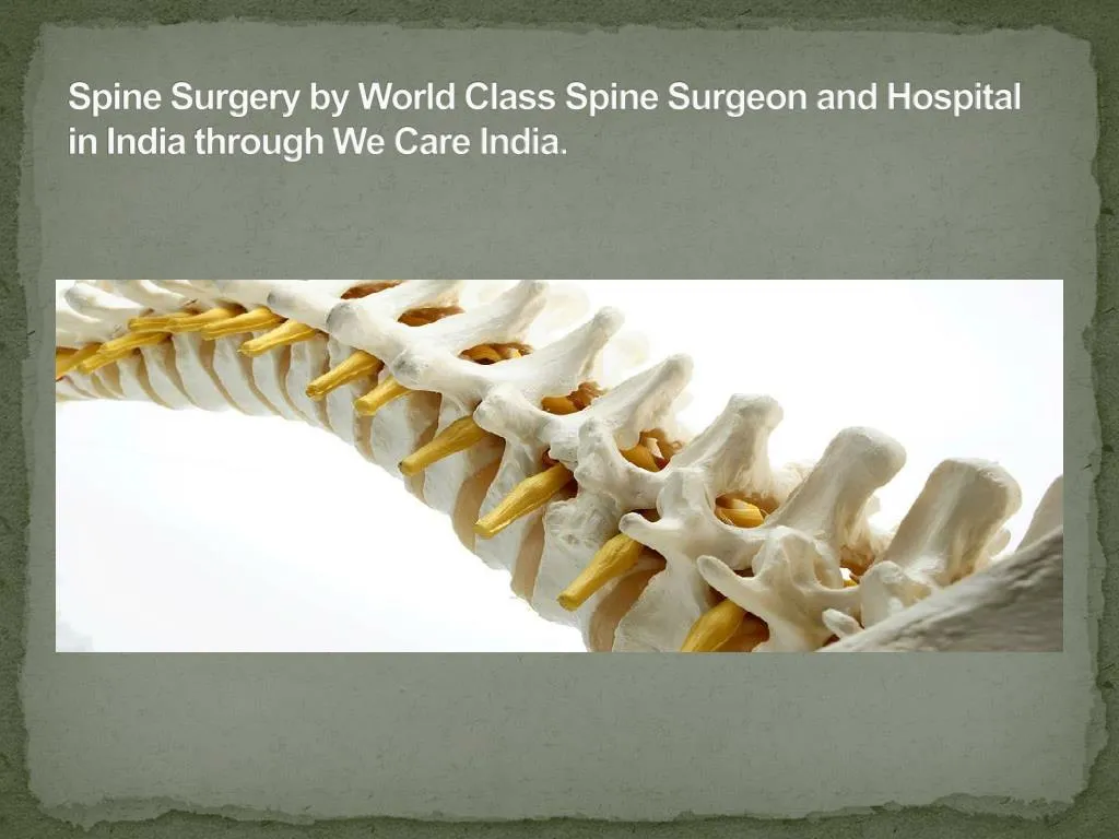 spine surgery by world class spine surgeon and hospital in india through we care india n.