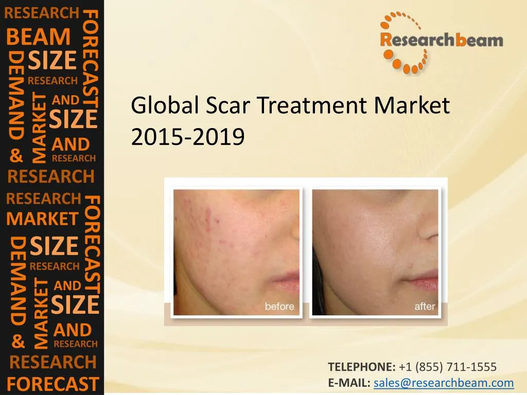 PPT Global Scar Treatment Market Size, Trends, Technology PowerPoint