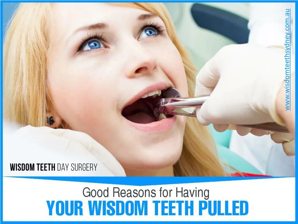 ppt-reliable-wisdom-teeth-removal-in-sydney-powerpoint-presentation