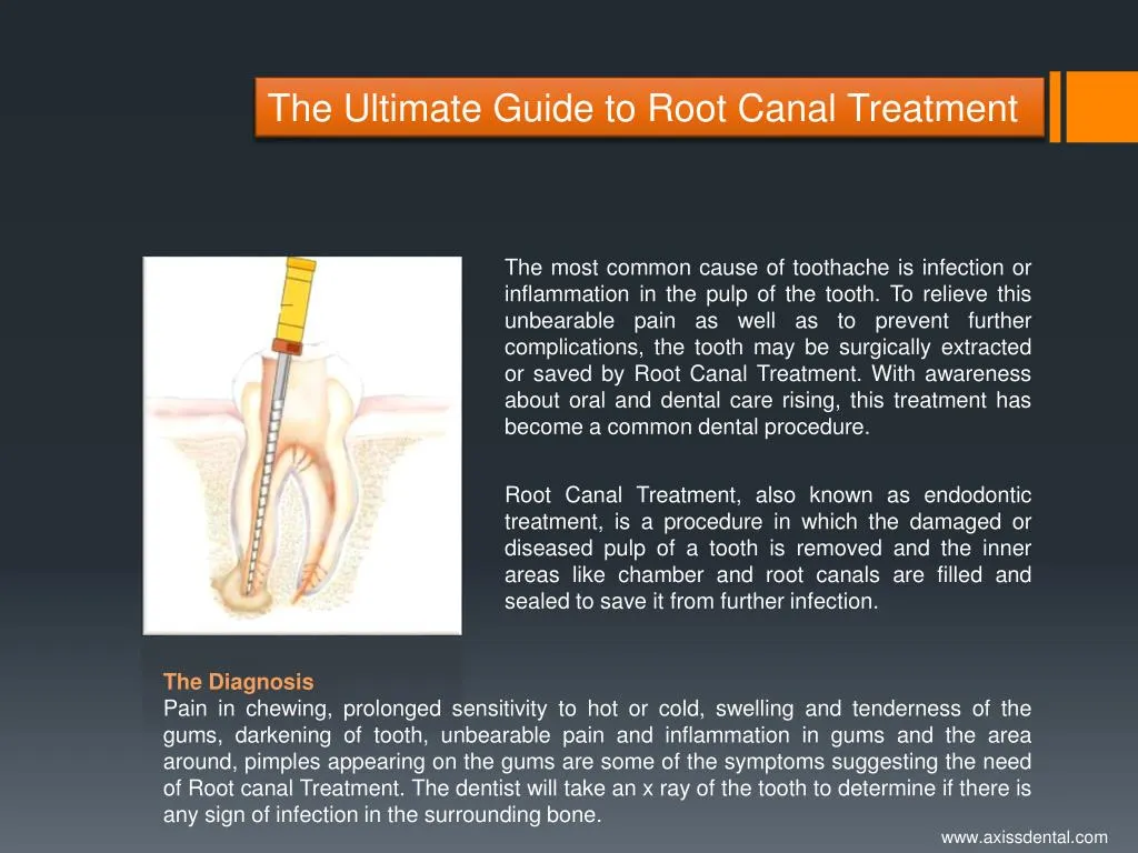 Ppt The Ultimate Guide To Root Canal Treatment Powerpoint Presentation Id 7189566