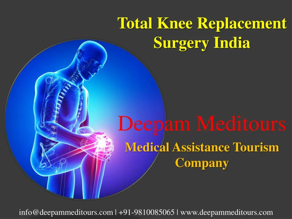 PPT - Total Knee Replacement Surgery India PowerPoint Presentation ...