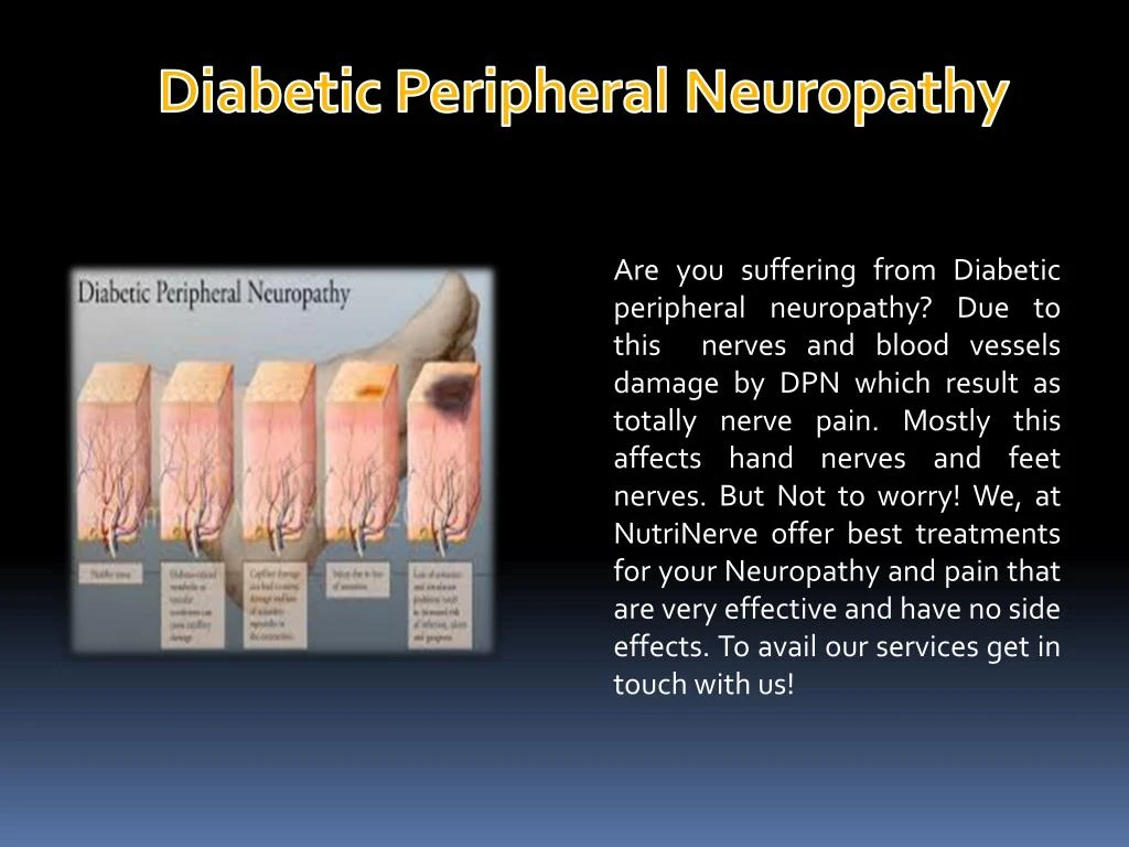 presentation of diabetic peripheral neuropathy