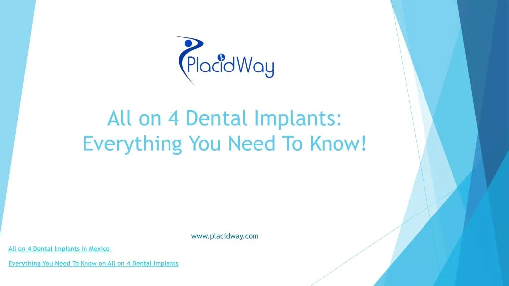 all on 4 dental implants everything you need to know n.