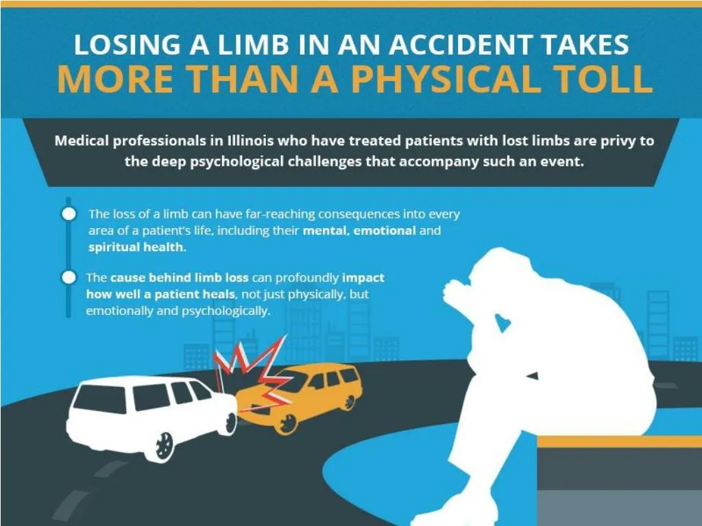 ppt-losing-a-limb-in-an-accident-takes-more-than-a-physical-toll