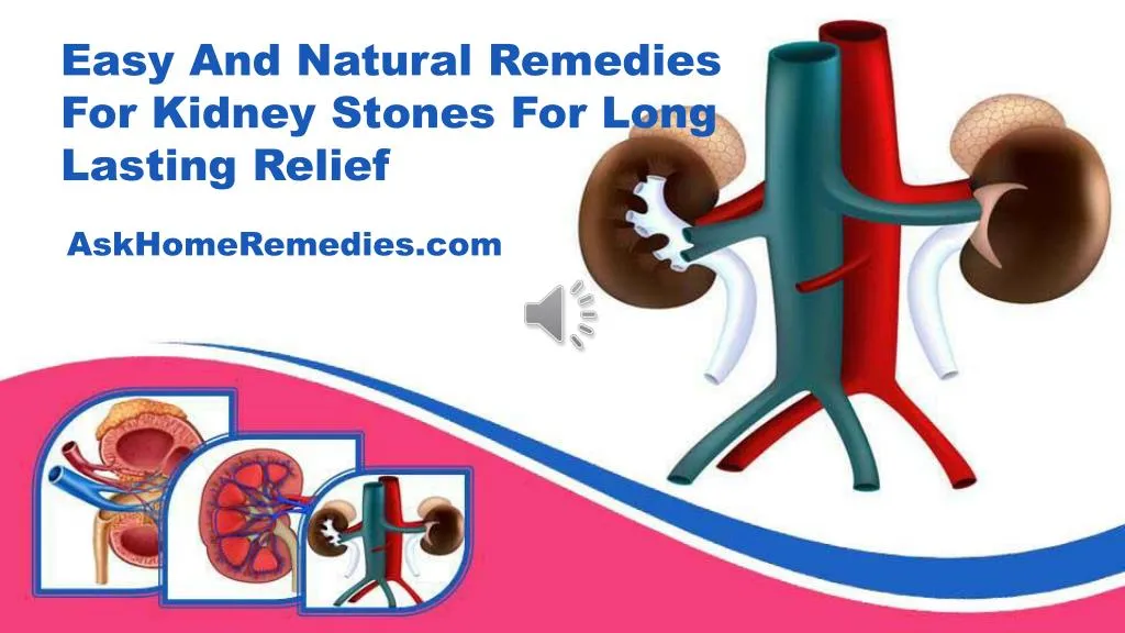 PPT - Easy And Natural Remedies For Kidney Stones For Long Lasting ...