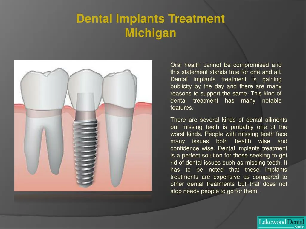 PPT Dental implant specialist Michigan PowerPoint Presentation, free
