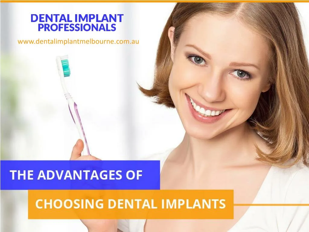 the advantages of choosing dental implants n.