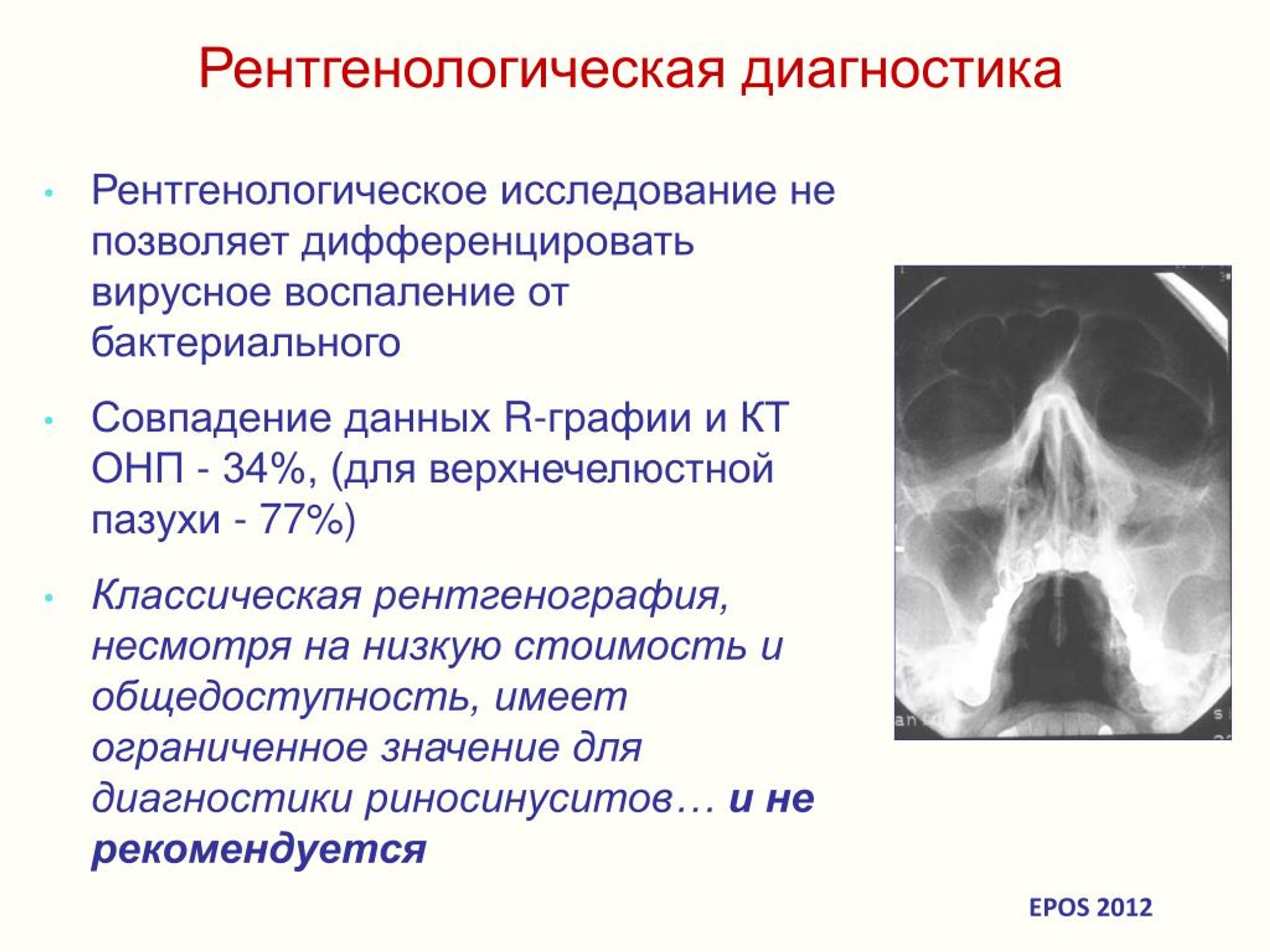 Хронический синусит клинические