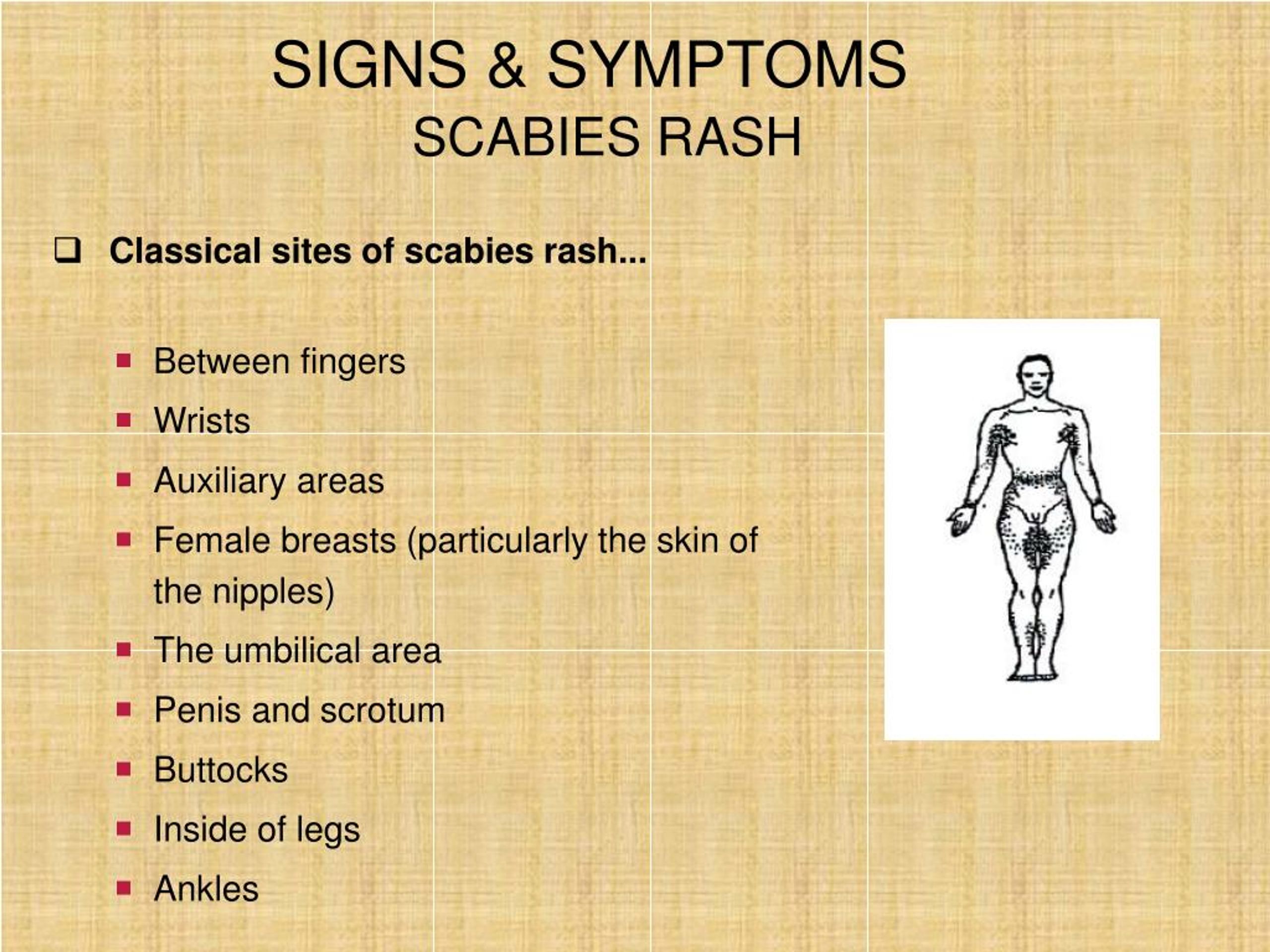 Ppt Scabies Life Cycle Diagnosis And Treatment Powerpoint Presentation Id7303283 9617