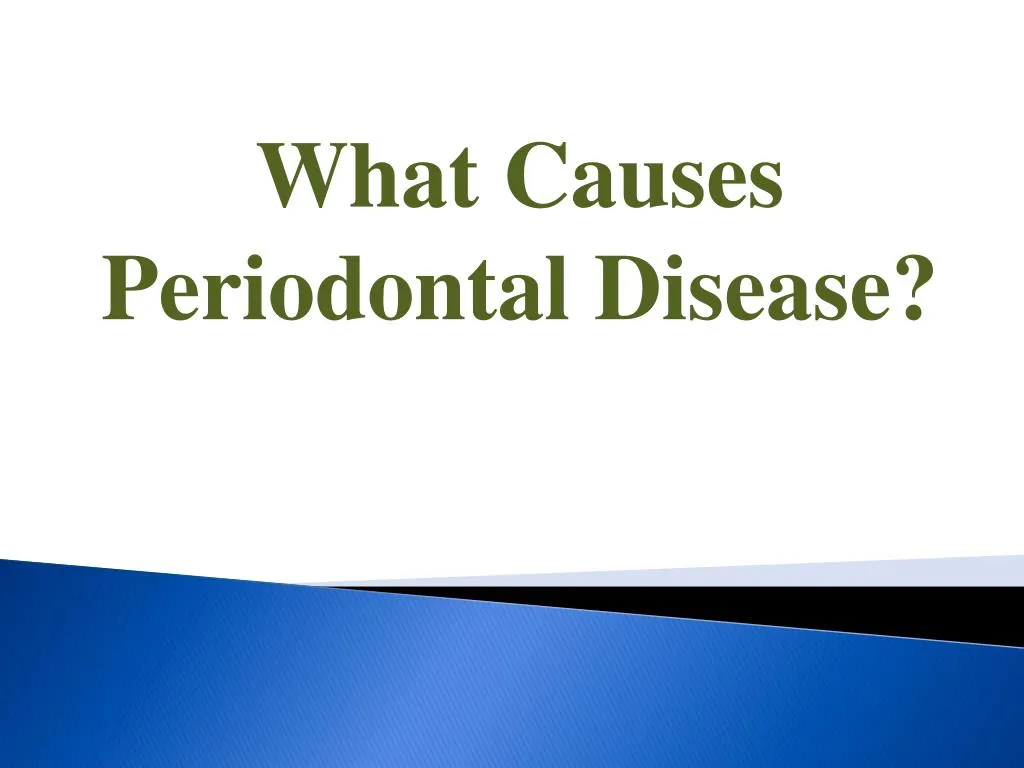 PPT - What Causes Periodontal Disease? PowerPoint Presentation, free ...