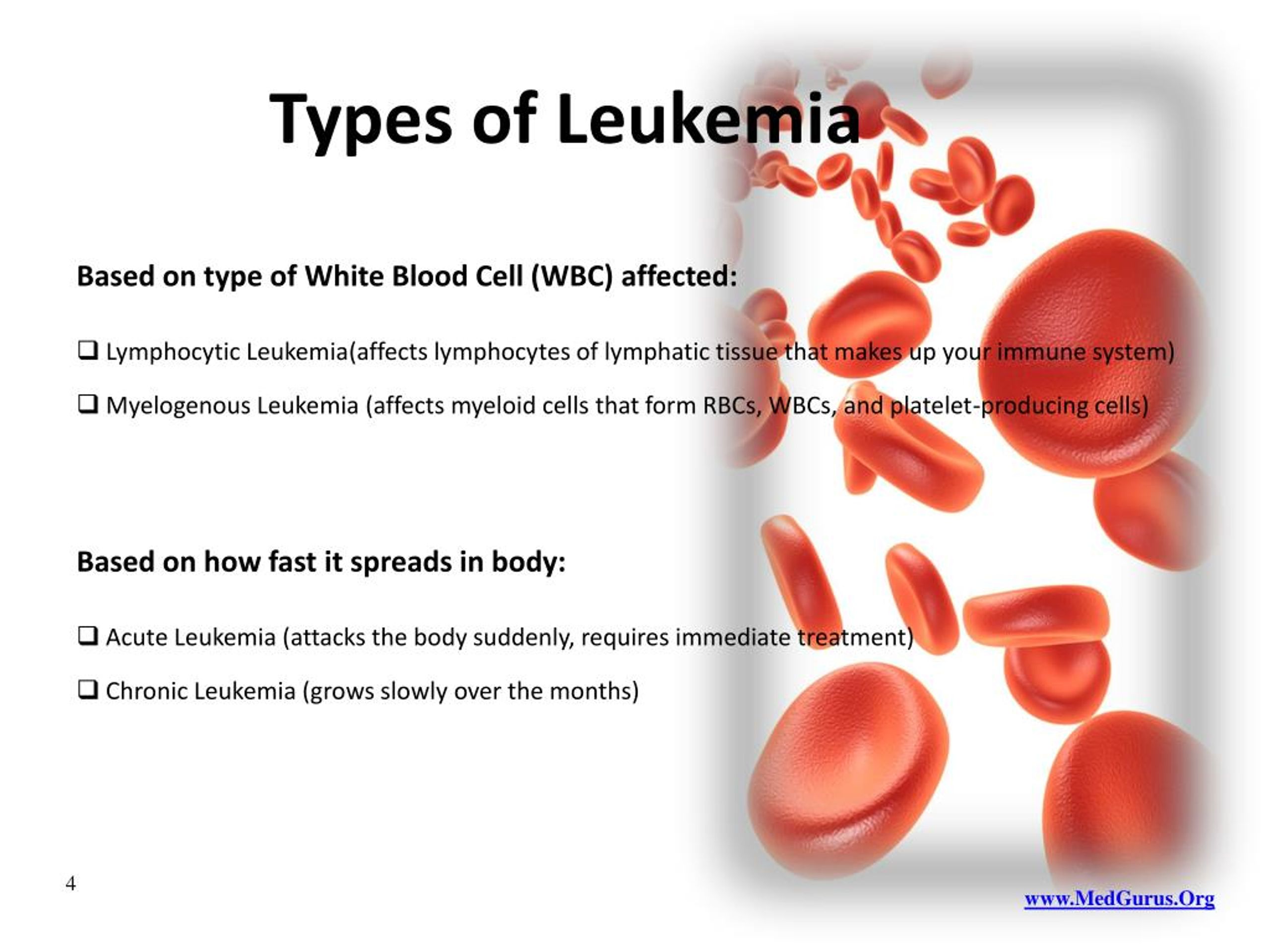 Ppt Understanding Leukemia Powerpoint Presentation Free Download