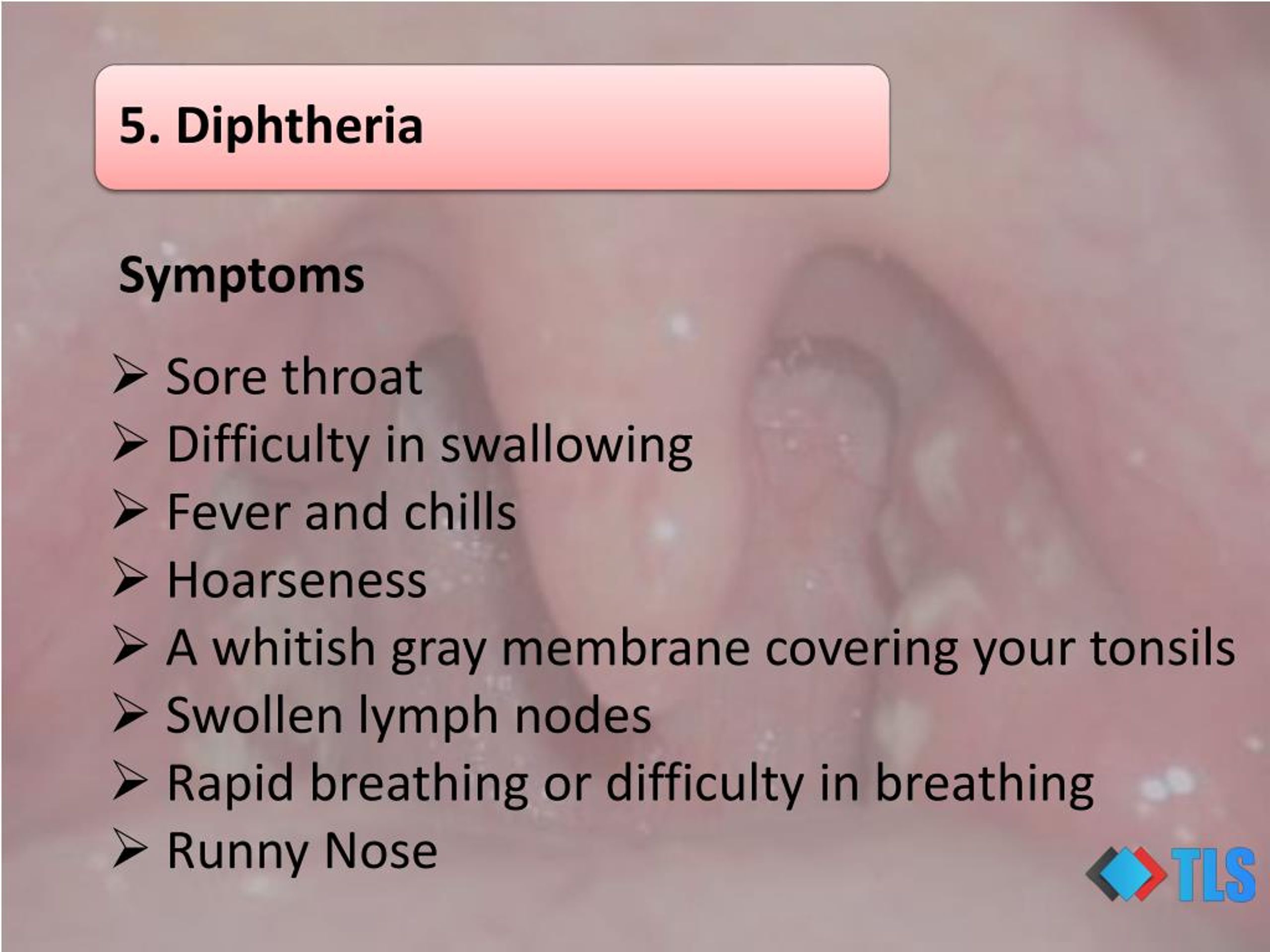 Ppt 8 Causes Of White Spots On Tonsils You May Not Know Powerpoint