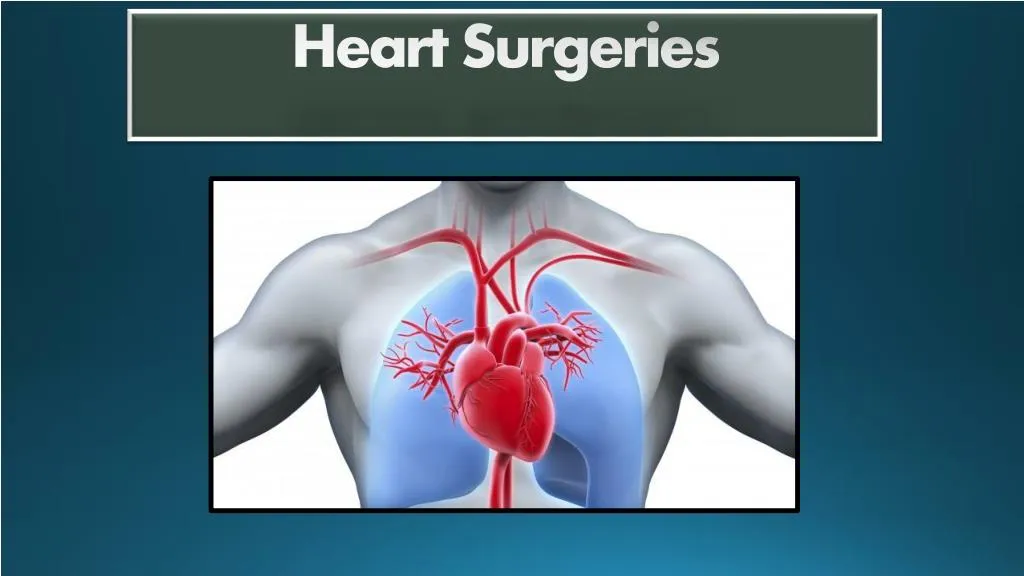 heart surgeries n.