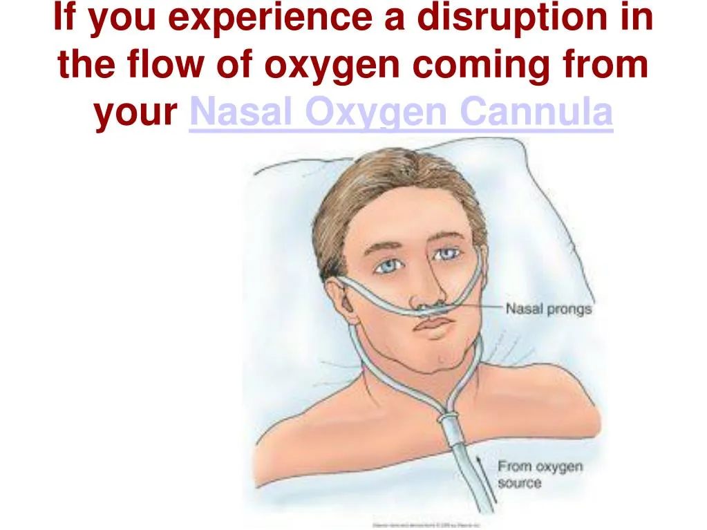 PPT - Use Nasal Oxygen Cannula with best instructions PowerPoint Presentation - ID:7332807