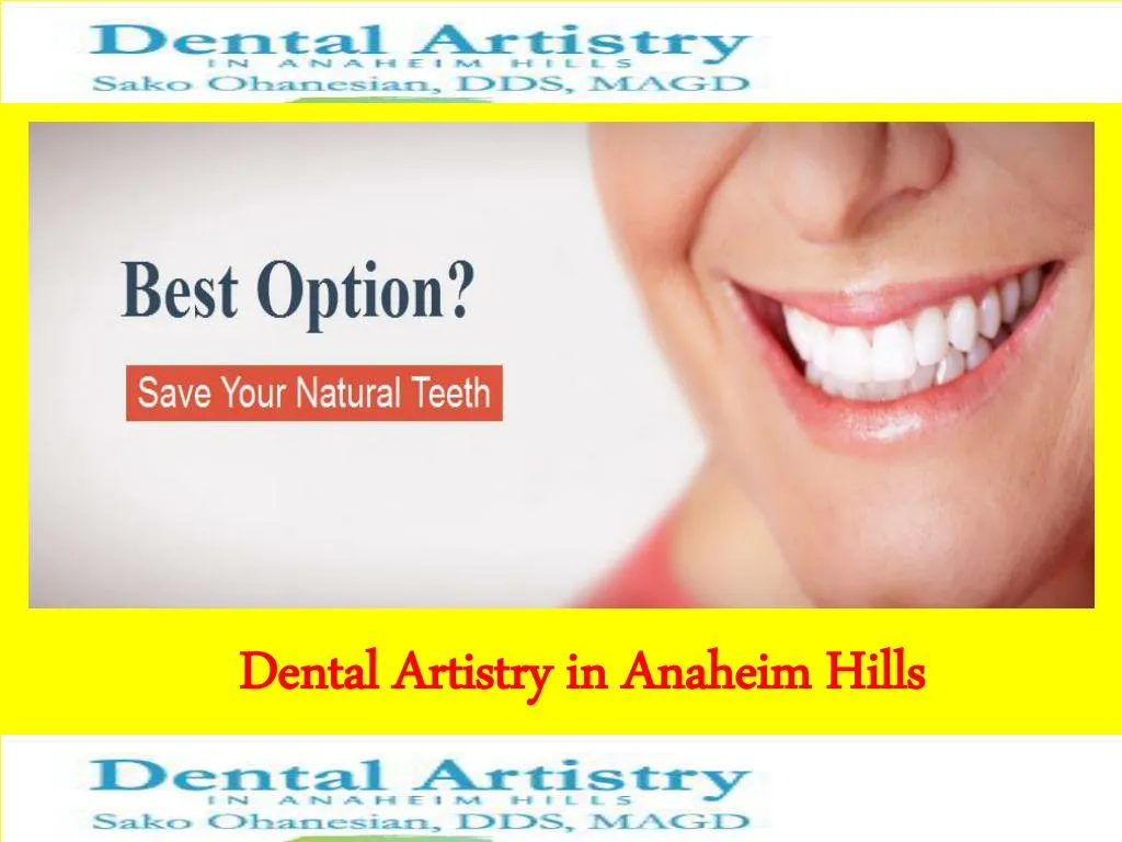 PPT Dental Implant Orange County PowerPoint Presentation, free download ID7342882