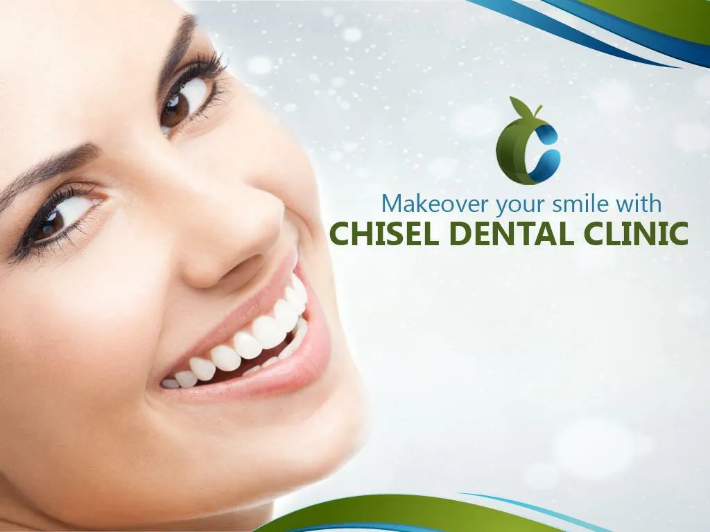 PPT Makeover your smile with Chisel Dental Clinic PowerPoint