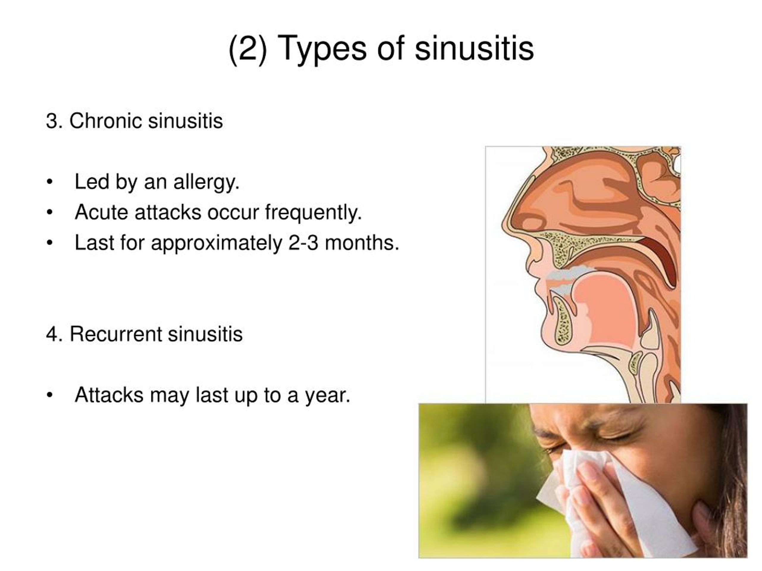 2) Types of sinusitis.