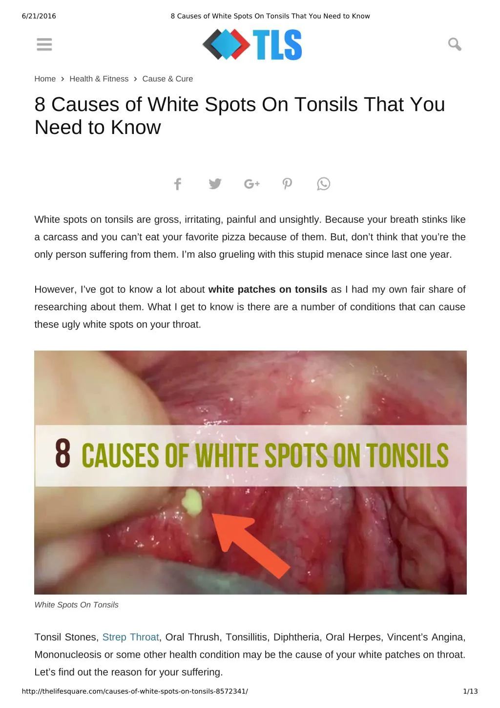 Ppt 8 Causes Of White Spots On Tonsils You May Not Know Powerpoint