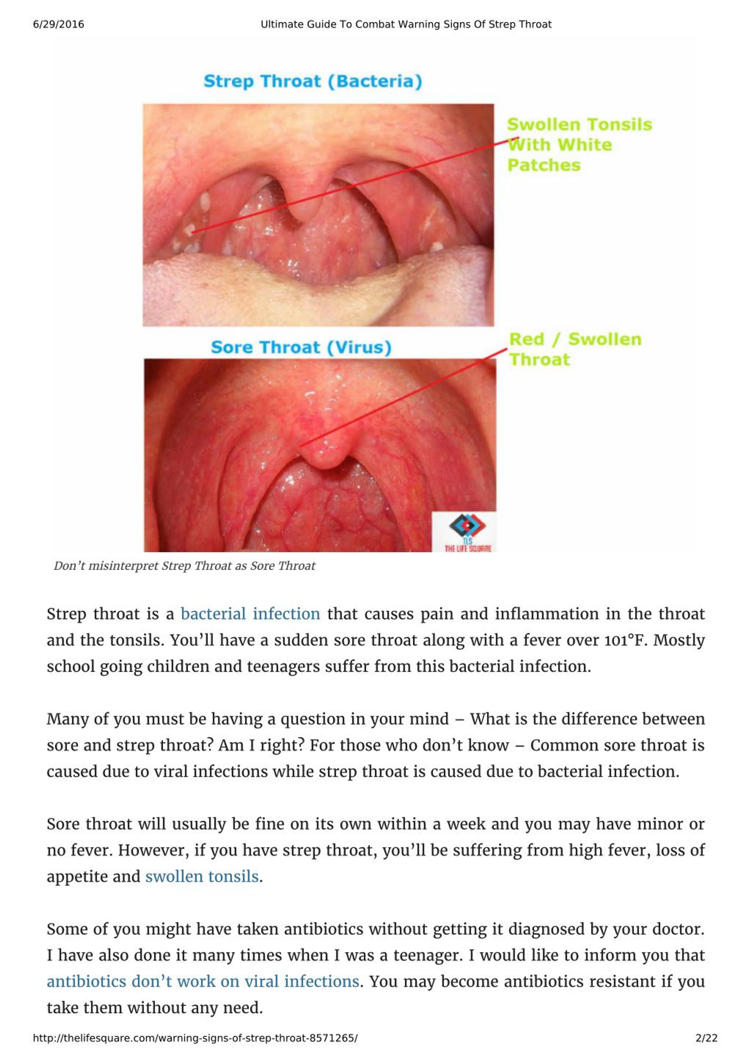 Example Of Strep Throat