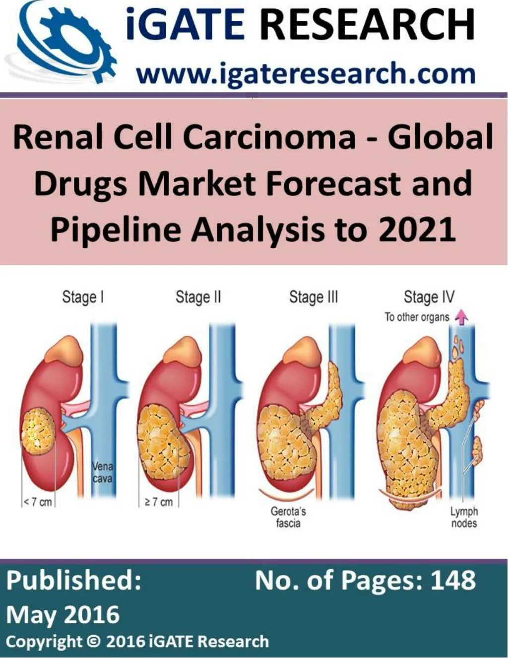 PPT Renal Cell Carcinoma Global Drugs Market Forecast