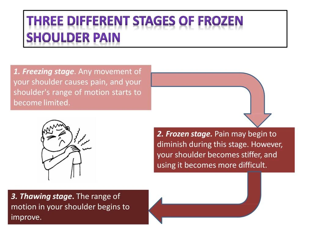 PPT - Stay fit with these frozen shoulder pain solutions PowerPoint ...