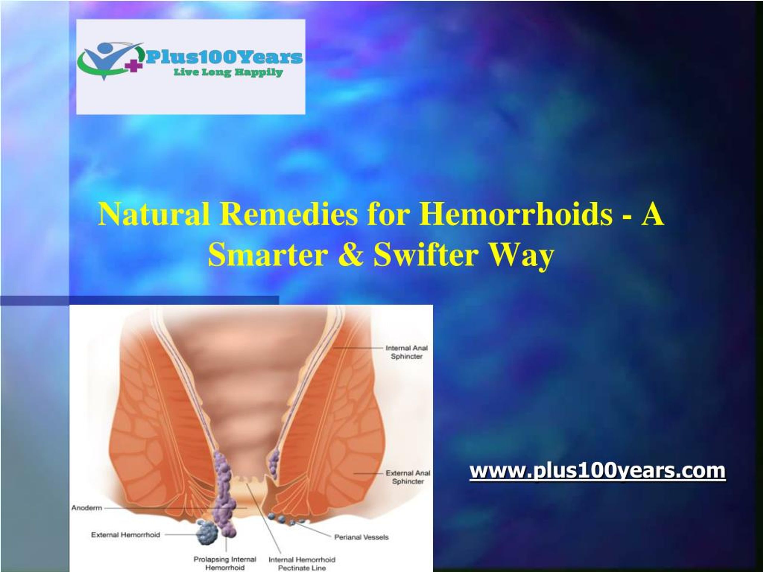 Ppt Natural Remedies For Hemorrhoids A Smarter And Swifter Way Powerpoint Presentation Id 1288