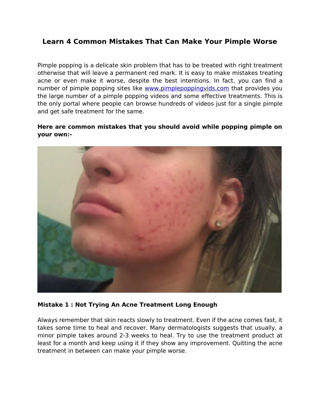 PPT - Learn 4 Common Mistakes That Can Make Your Pimple Worse ...