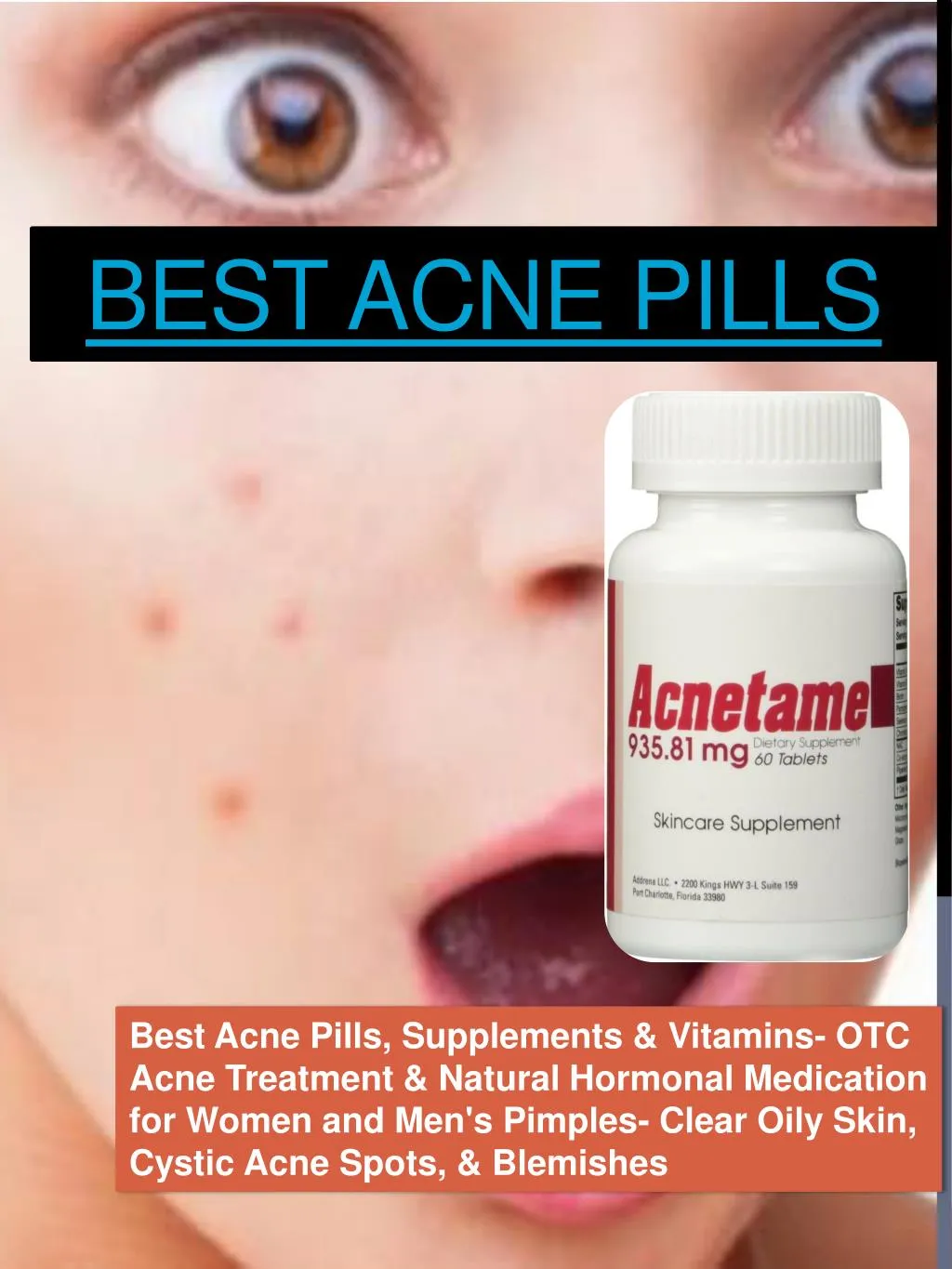 PPT Acne Pills PowerPoint Presentation, free download ID7397308