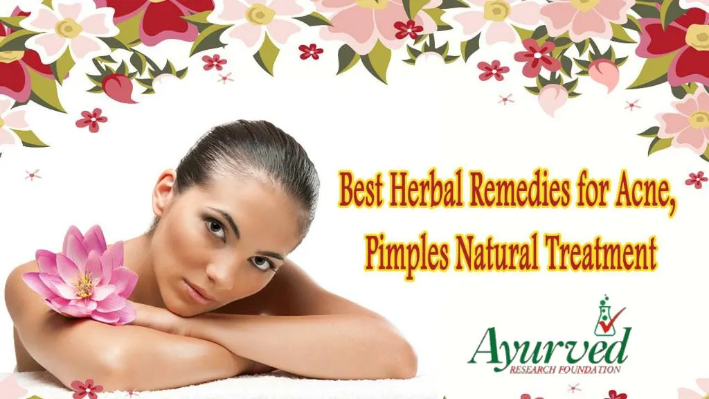 PPT Best Herbal Remedies for Acne, Pimples Natural Treatment