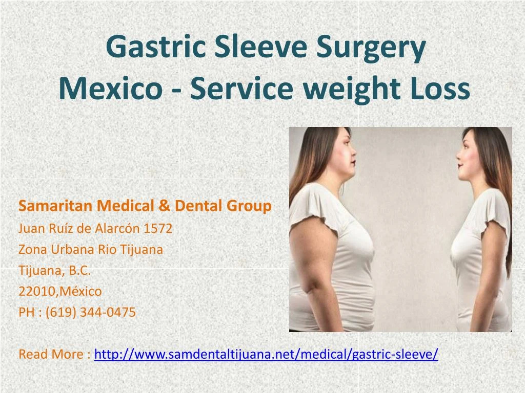 gastric sleeve surgery mexico service weight loss n.