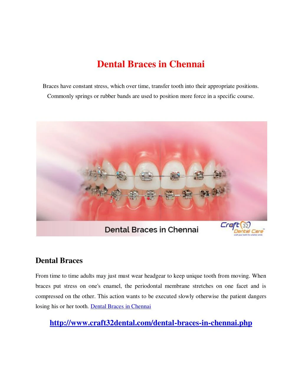 PPT - Dental Braces In Chennai PowerPoint Presentation, Free Download ...