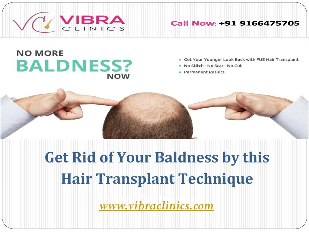 get rid of your baldness by this hair transplant technique ant technique n.