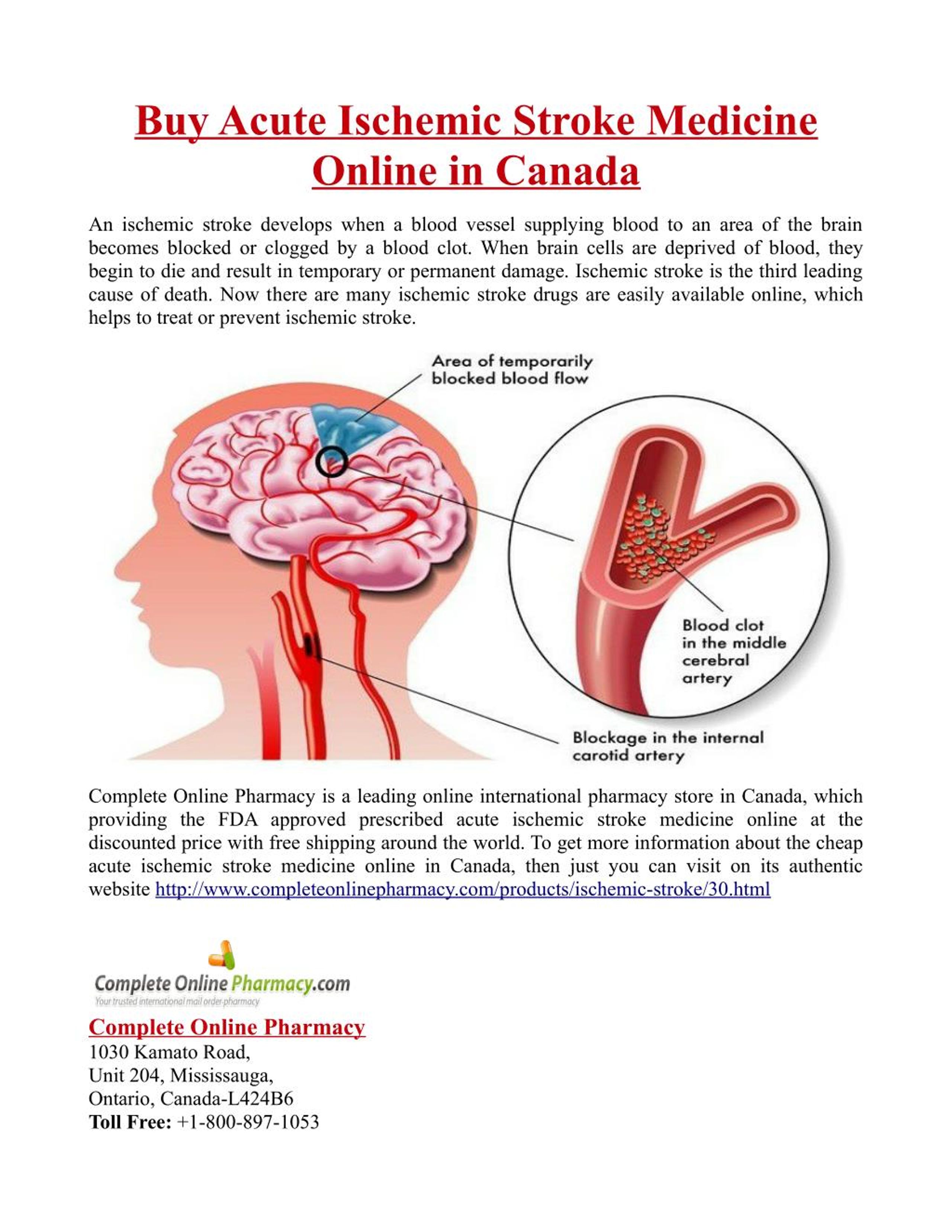 PPT Buy Acute Ischemic Stroke Medicine Online In Canada PowerPoint   Slide1 L 